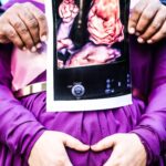 Maternity